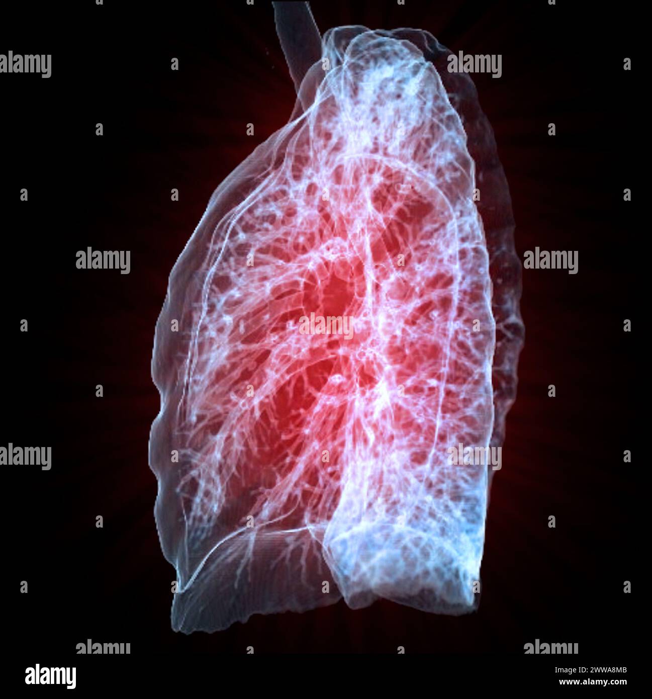 Immagine di rendering TC toracica o polmonare 3d che mostra trachea e polmoni nel sistema respiratorio. Foto Stock