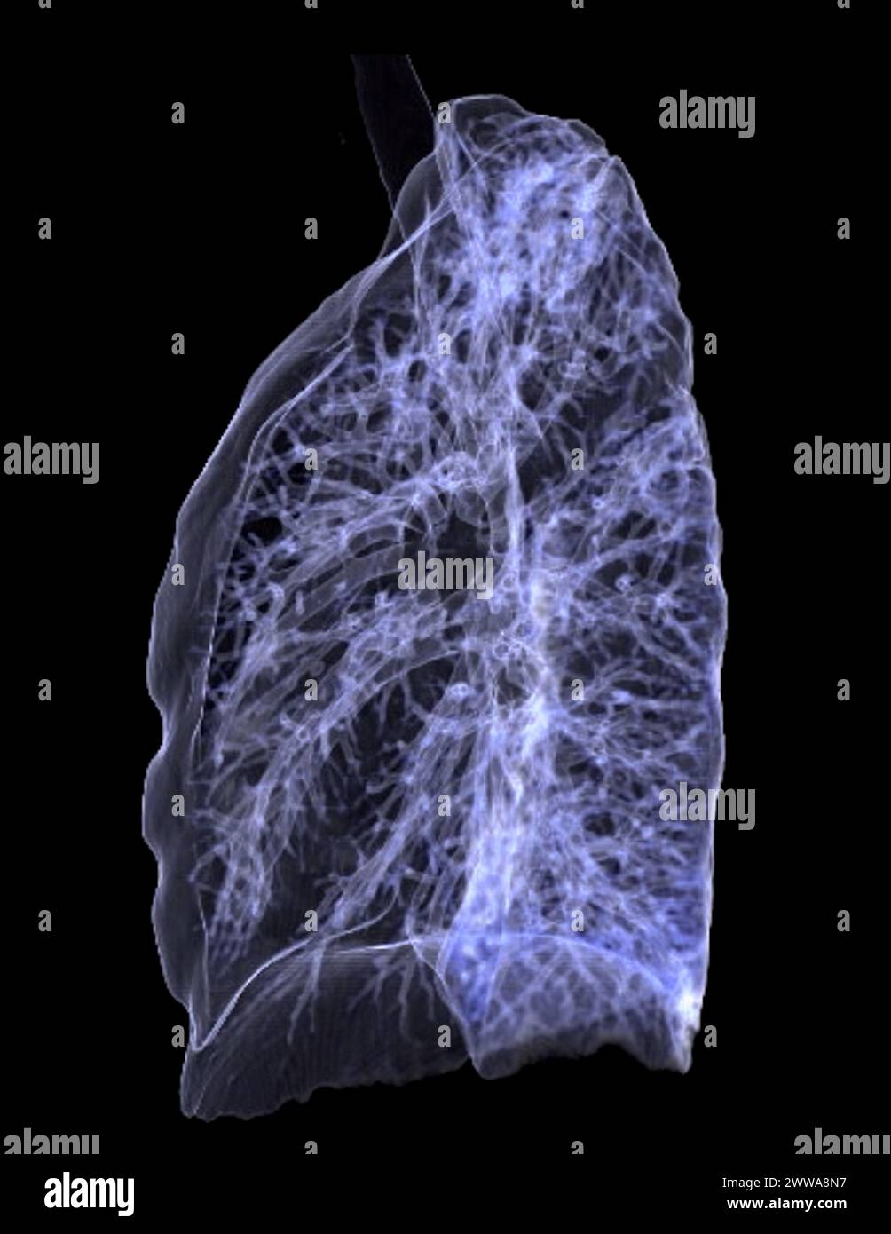 Immagine di rendering TC toracica o polmonare 3d che mostra trachea e polmoni nel sistema respiratorio. Foto Stock
