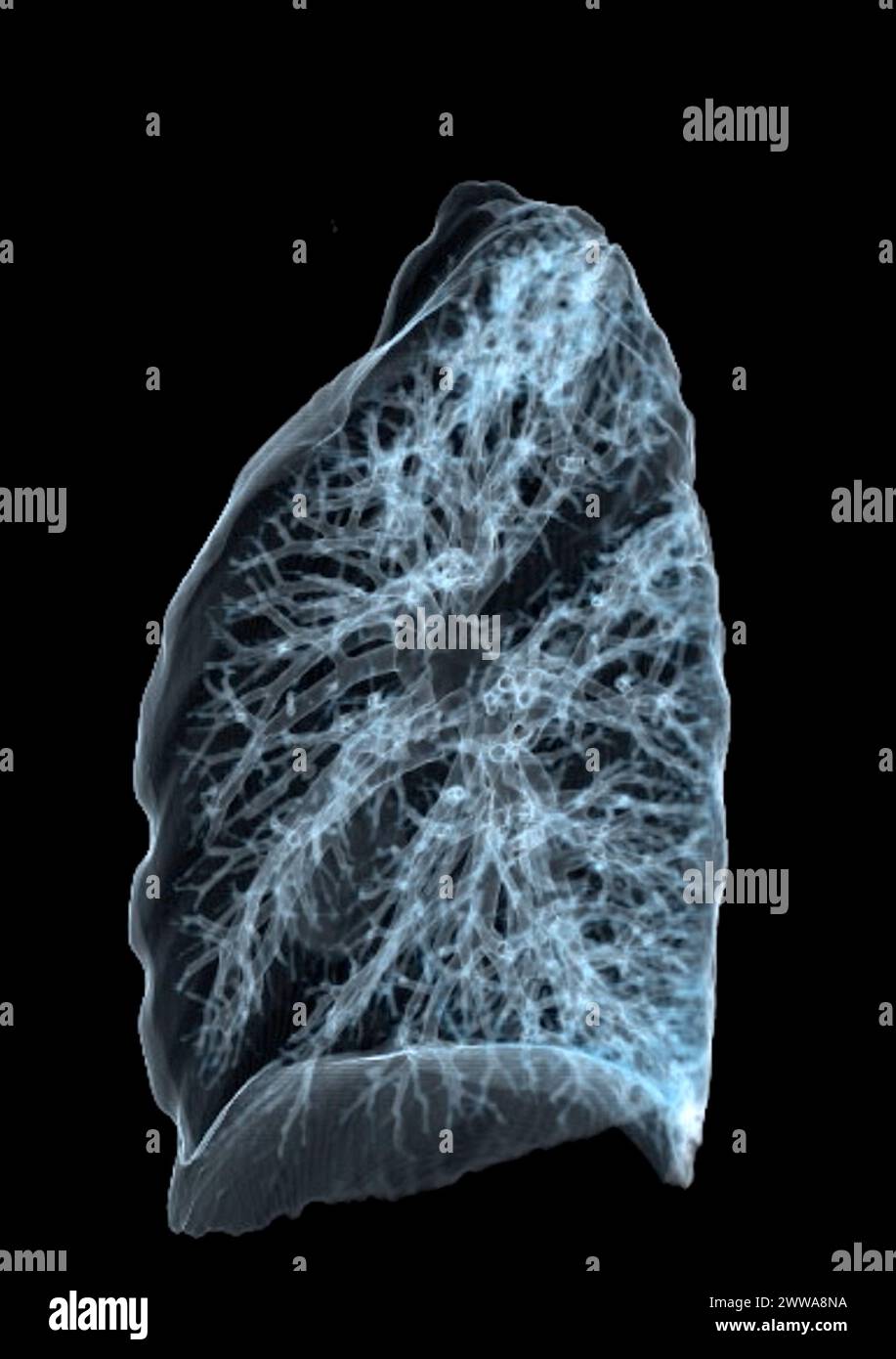 Immagine di rendering TC toracica o polmonare 3d che mostra trachea e polmoni nel sistema respiratorio. Foto Stock
