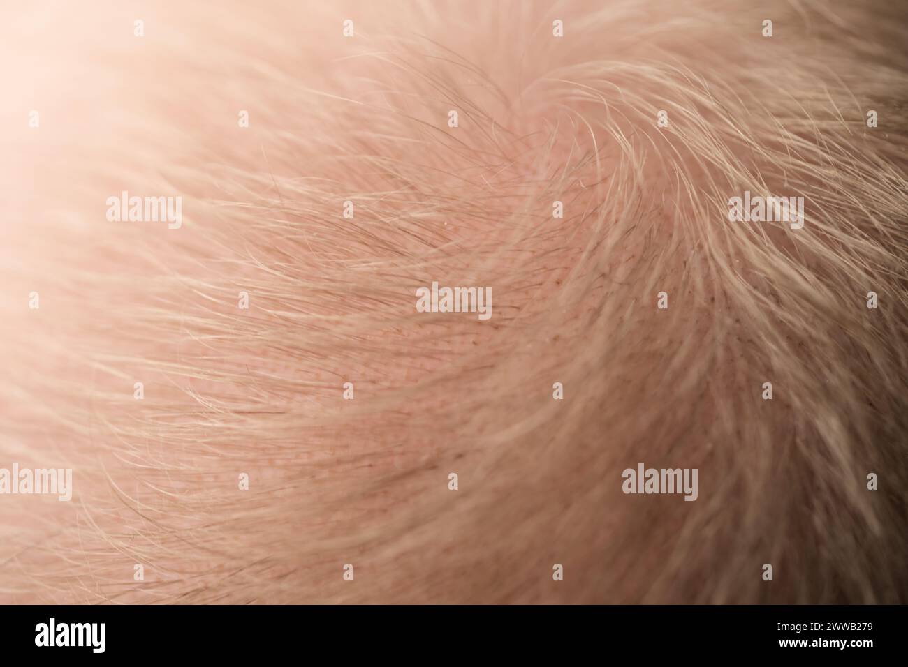 Macro shot di perdita dei capelli problema di primo piano dei capelli biondi, messa a fuoco superficiale Foto Stock