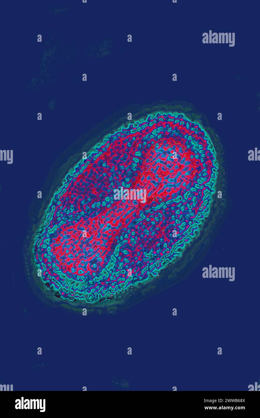 Virus Variola (i poxvirus sono virus di grandi dimensioni di 300/200/100 nm. Foto Stock