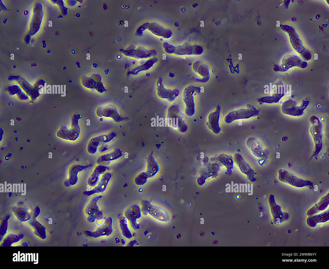 Un monte umido di Naegleria fowleri trophozoites coltivato dal liquido cerebrospinale di un paziente con meningoencefalite amebica primaria visto. Foto Stock