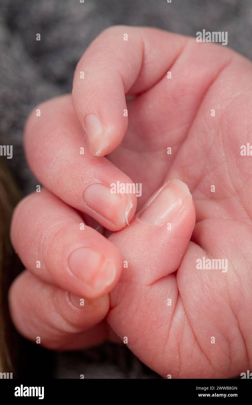 Mano del neonato a 3 giorni. Foto Stock