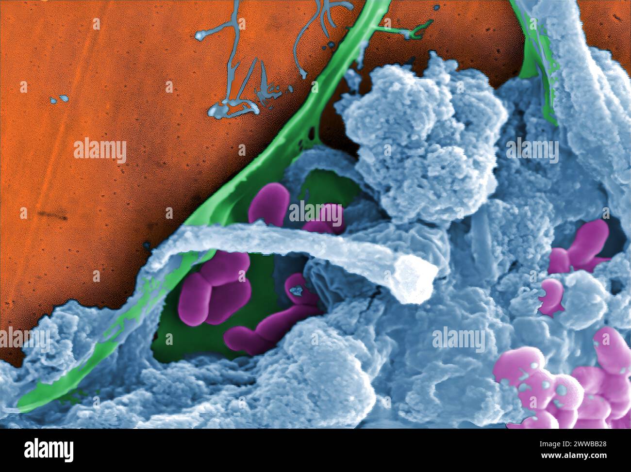 Immagine SEM (Electron Microscopic) a scansione a colori digitale di un campione d'acqua non trattato estratto da un flusso selvatico utilizzato principalmente per il controllo. Foto Stock