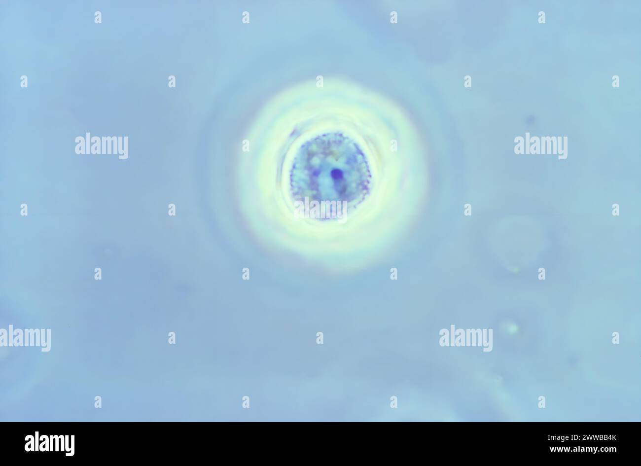 Utilizzando l'imaging a contrasto di fase e il 1125X ingrandito, questo fotomicrografo raffigura una cisti del protozoo Acanthamoeba polyphaga. Foto Stock