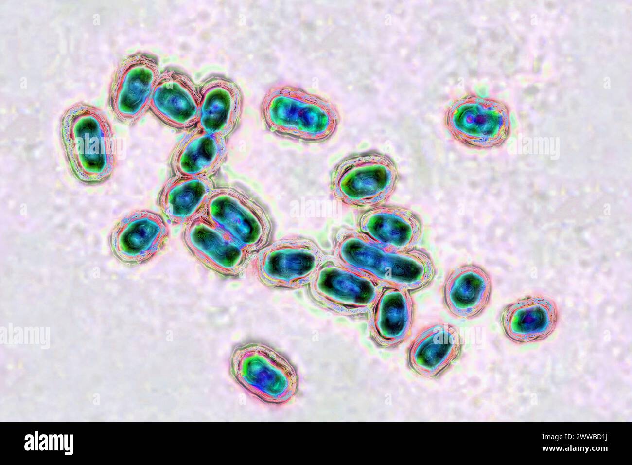 Pneumococco (Streptococcus pneumoniae), pneumococco è un batterio coinvolto in polmonite, broncopolmonite, pleurisia purulenta, meningite batterica. Foto Stock