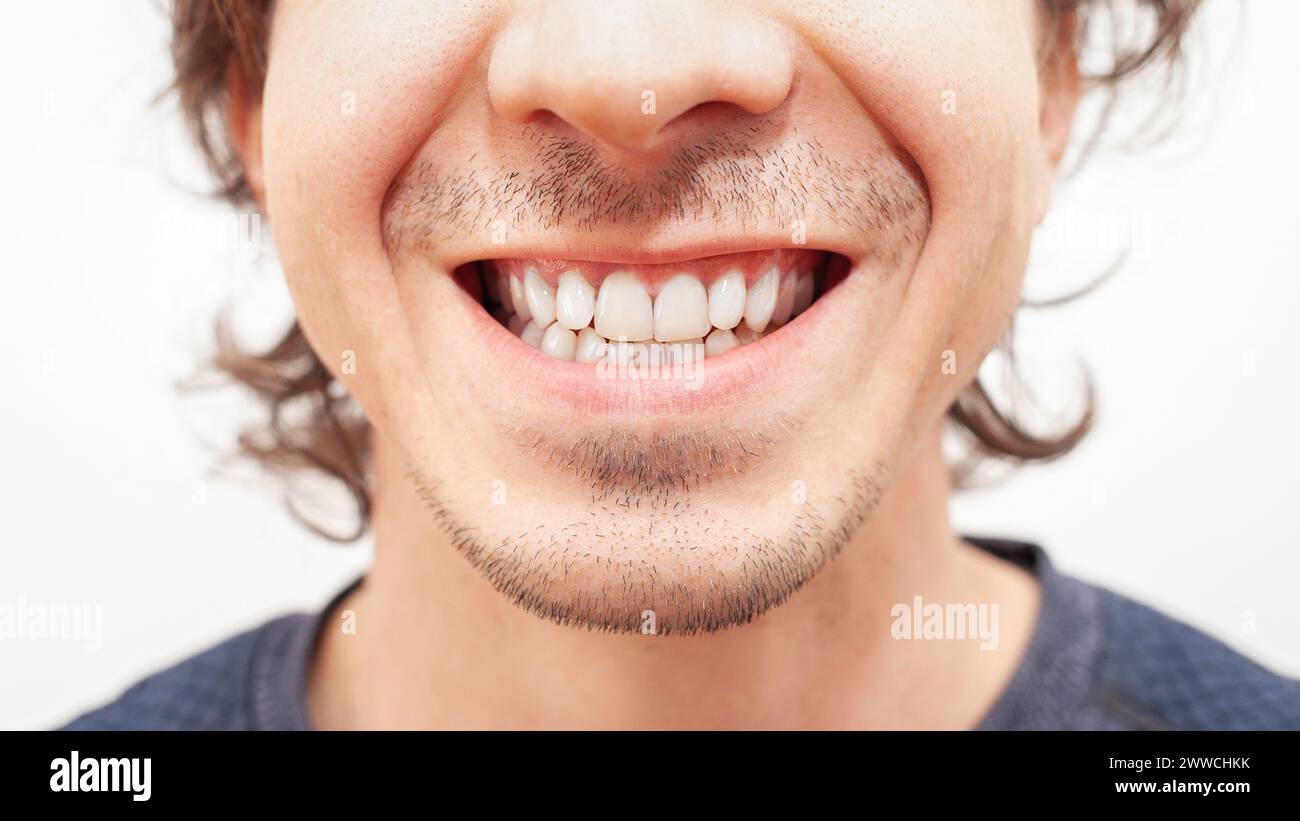 Primo piano ritratto sorriso denti uomo. denti bianchi bellissimi dopo lo sbiancamento, allineamento isolato Foto Stock