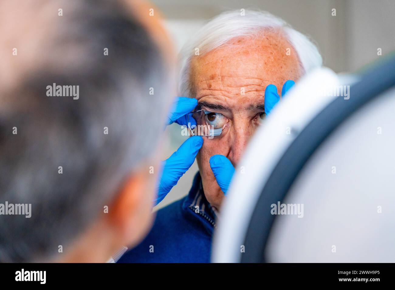 Oftalmologo che mette un dispositivo di apertura per gli occhi a un uomo anziano che lo prepara per un trattamento laser per il glaucoma Foto Stock