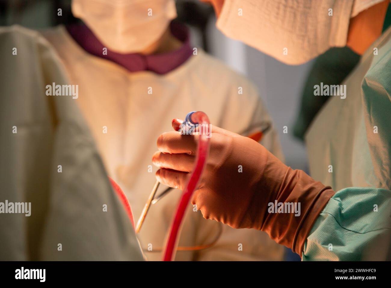 I chirurghi eseguono un'operazione. Foto reali dell'operazione. Una vera sala operatoria. Foto di alta qualità Foto Stock