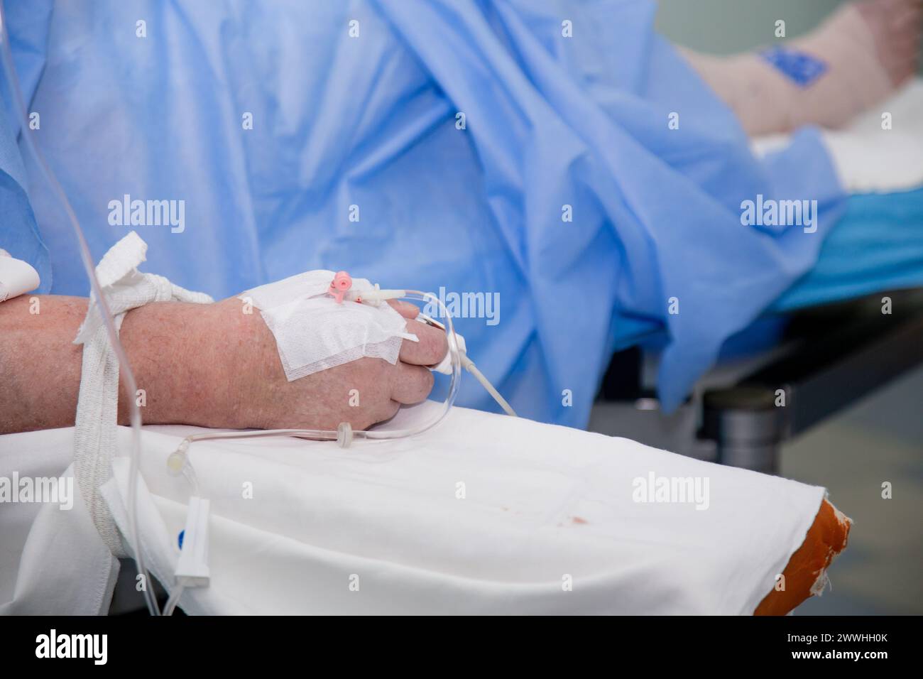 Il paziente è pronto per l'intervento. Vera sala operatoria. Foto Stock