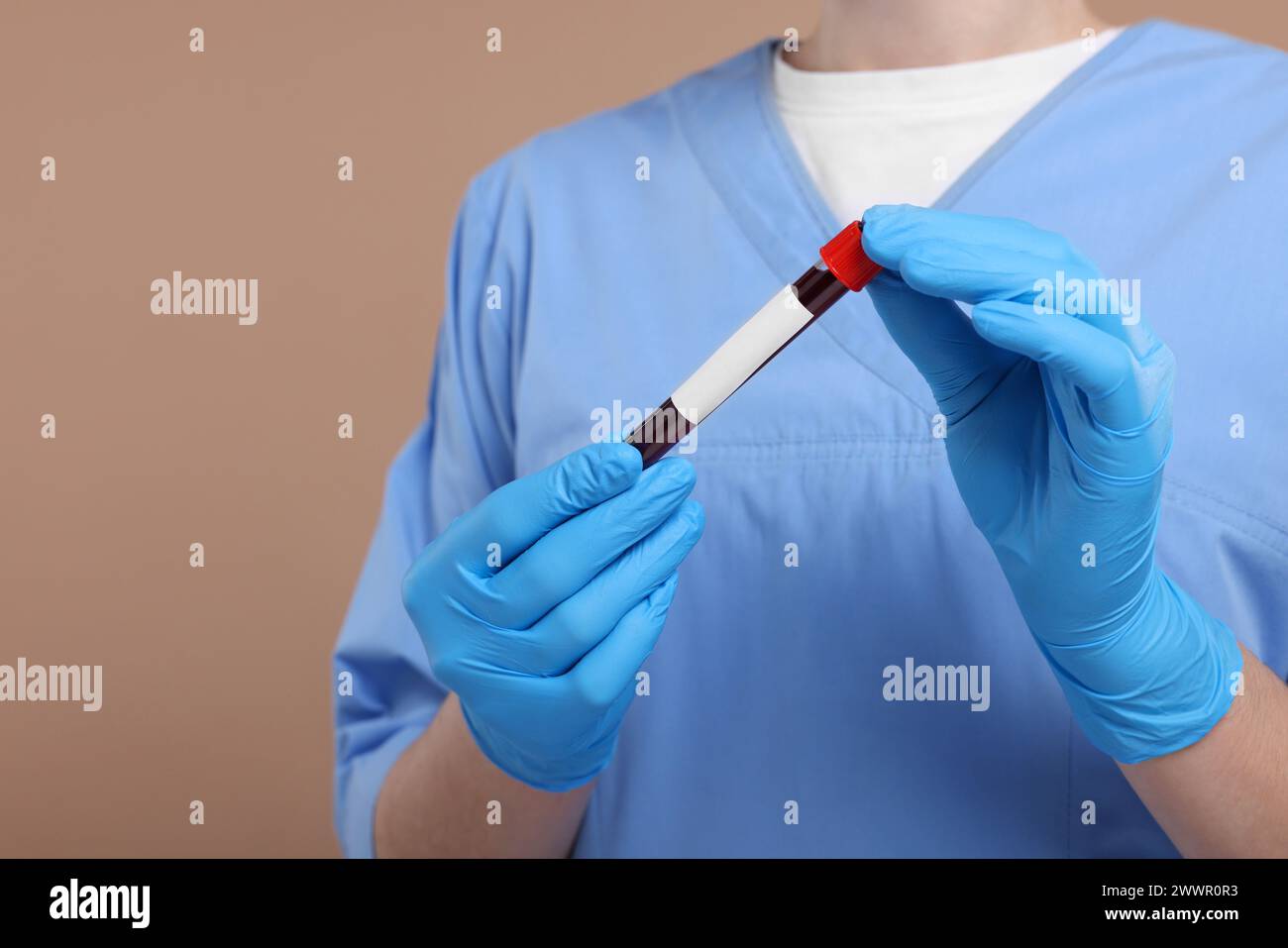 Analisi di laboratorio. Medico con campione di sangue nella provetta su sfondo marrone chiaro, primo piano Foto Stock