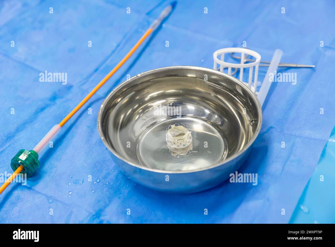Chirurgia della valvola cardiaca cardiologica per paziente in ospedale. Preparare l'impianto della valvola aortica transcaterica in mano al medico. Foto Stock