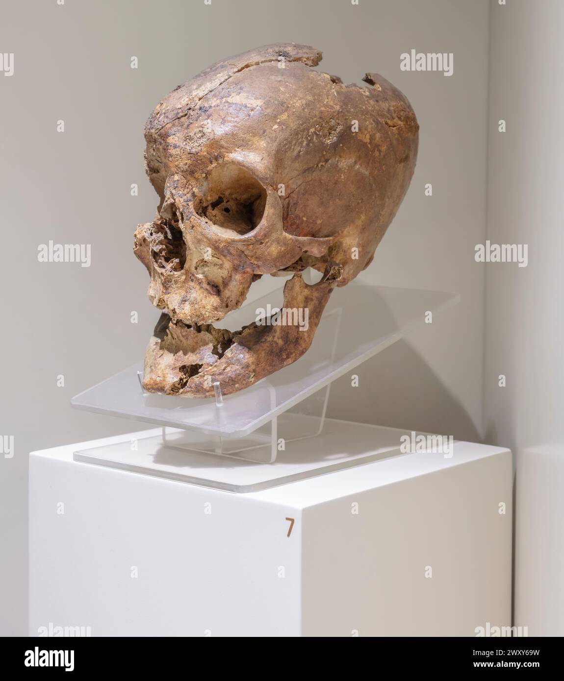 Cranio di Midas, Museo delle civiltà anatoliche, Ankara, Turchia Foto Stock