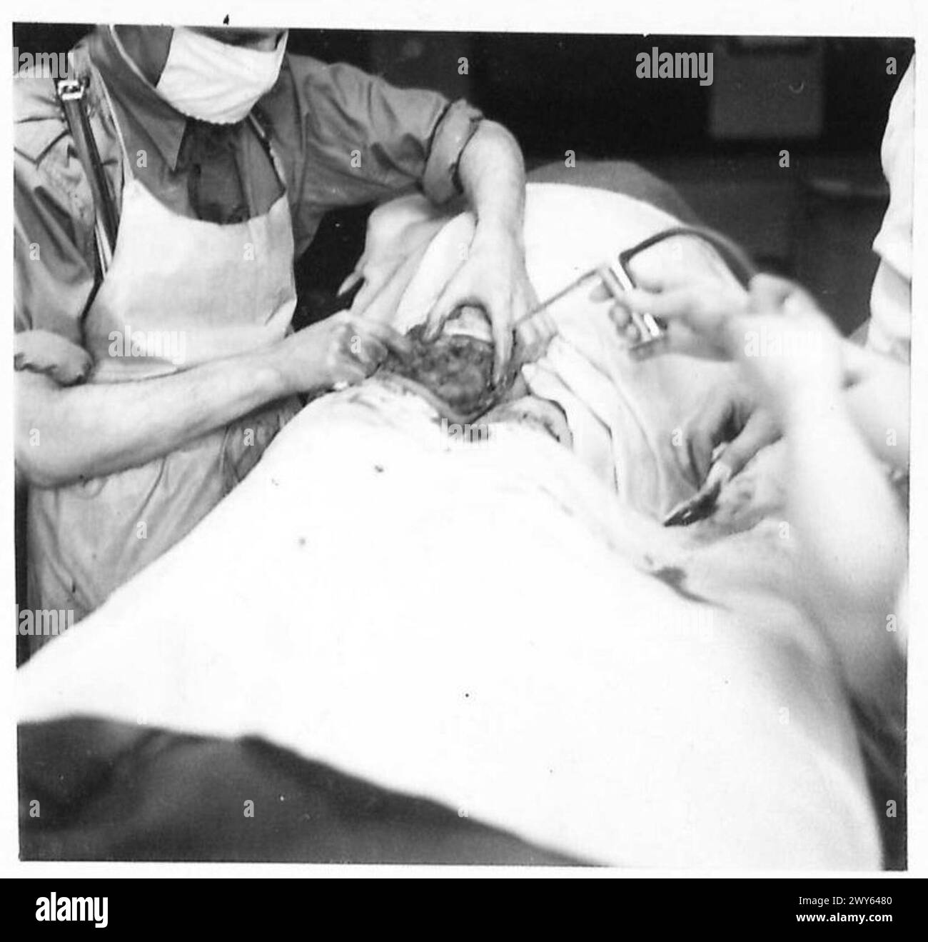 Dopo l'operazione, le ferite sono state trattate con iniezioni di penicillina e medicazione da personale medico dell'esercito britannico del 21st Army Group. Foto Stock