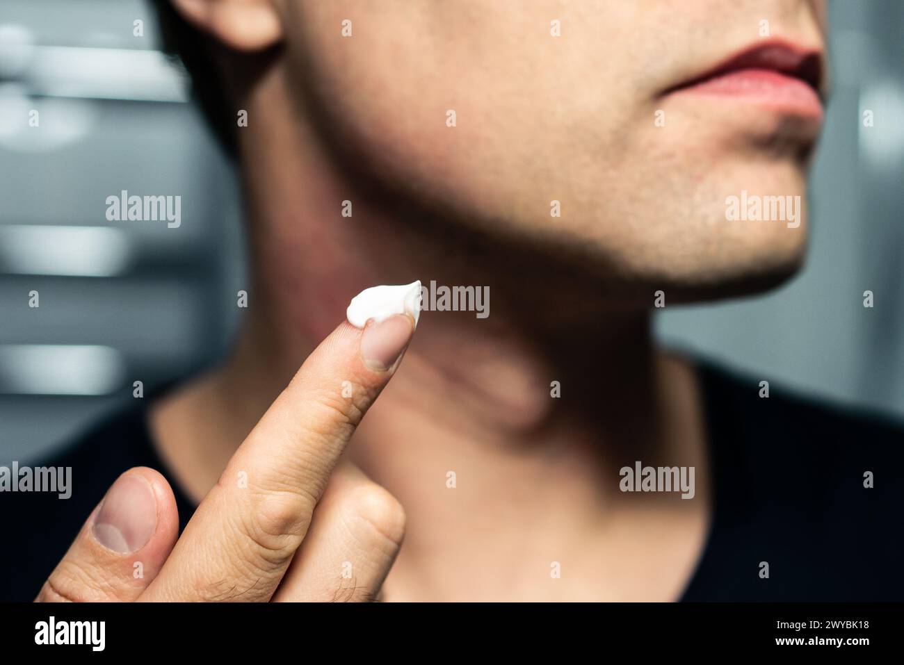 Crema per il viso e lozione. Cura della pelle. Uomo che applica crema solare, crema idratante o dopobarba. Trattamento viso maschile. Routine idratante. Trattamento per eruzione cutanea. Foto Stock