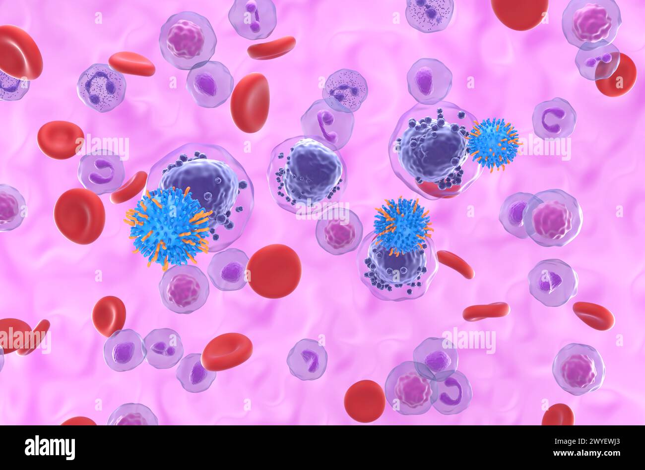 Terapia con cellule T di CAR nella leucemia mieloide acuta (AML) - Vista isometrica illustrazione 3d. Foto Stock