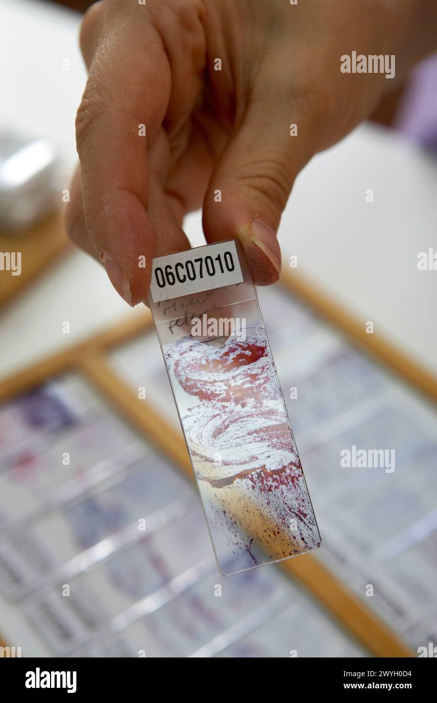 Anatomia patologica, Hospital de Zumarraga,. Foto Stock