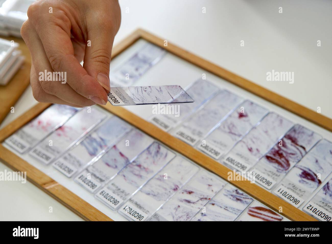 Anatomia patologica, Hospital de Zumarraga,. Foto Stock