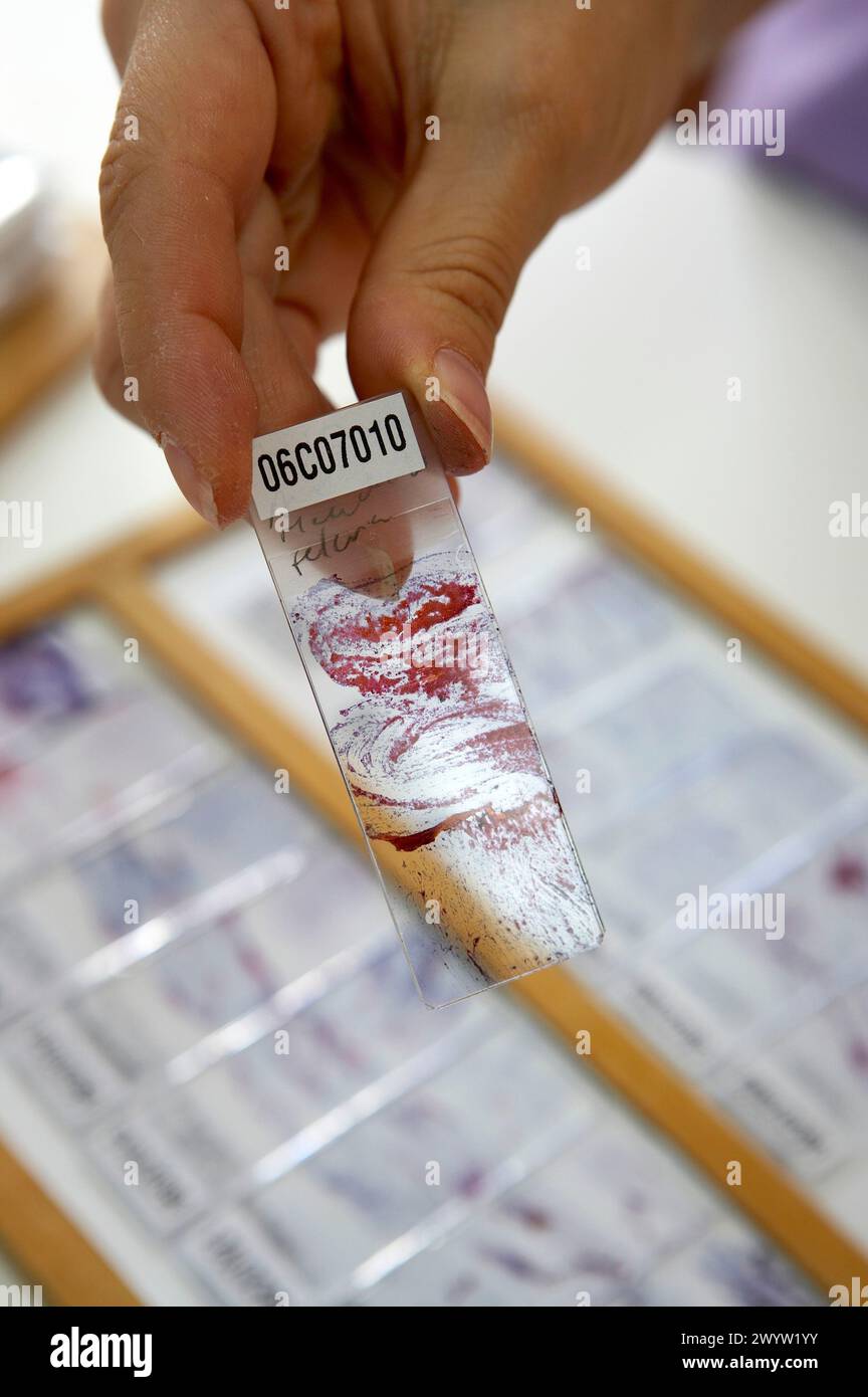 Anatomia patologica, Hospital de Zumarraga,. Foto Stock