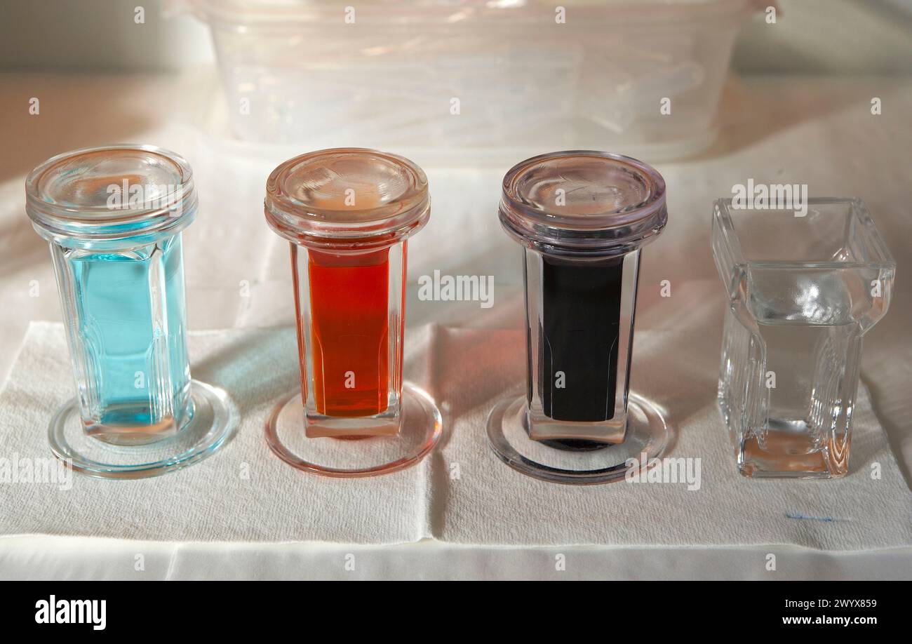 Anatomia patologica, Hospital de Zumarraga,. Foto Stock