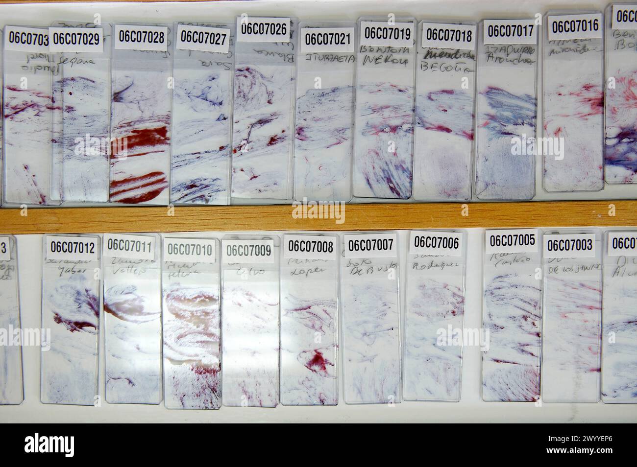 Anatomia patologica, Hospital de Zumarraga,. Foto Stock