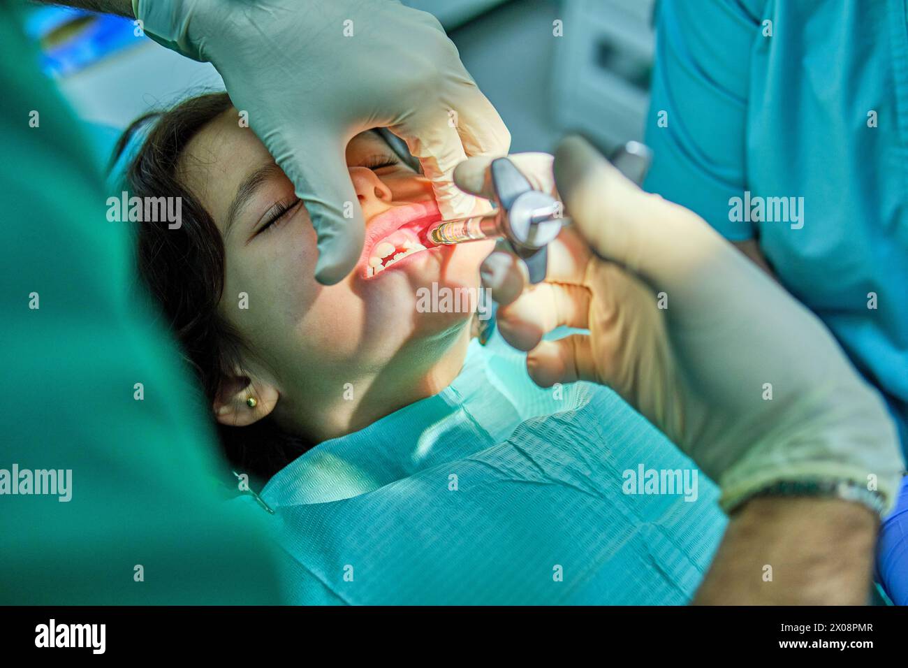 Un bambino riceve cure odontoiatriche esperte, evidenziando le tecniche delicate utilizzate nell'odontoiatria pediatrica Foto Stock