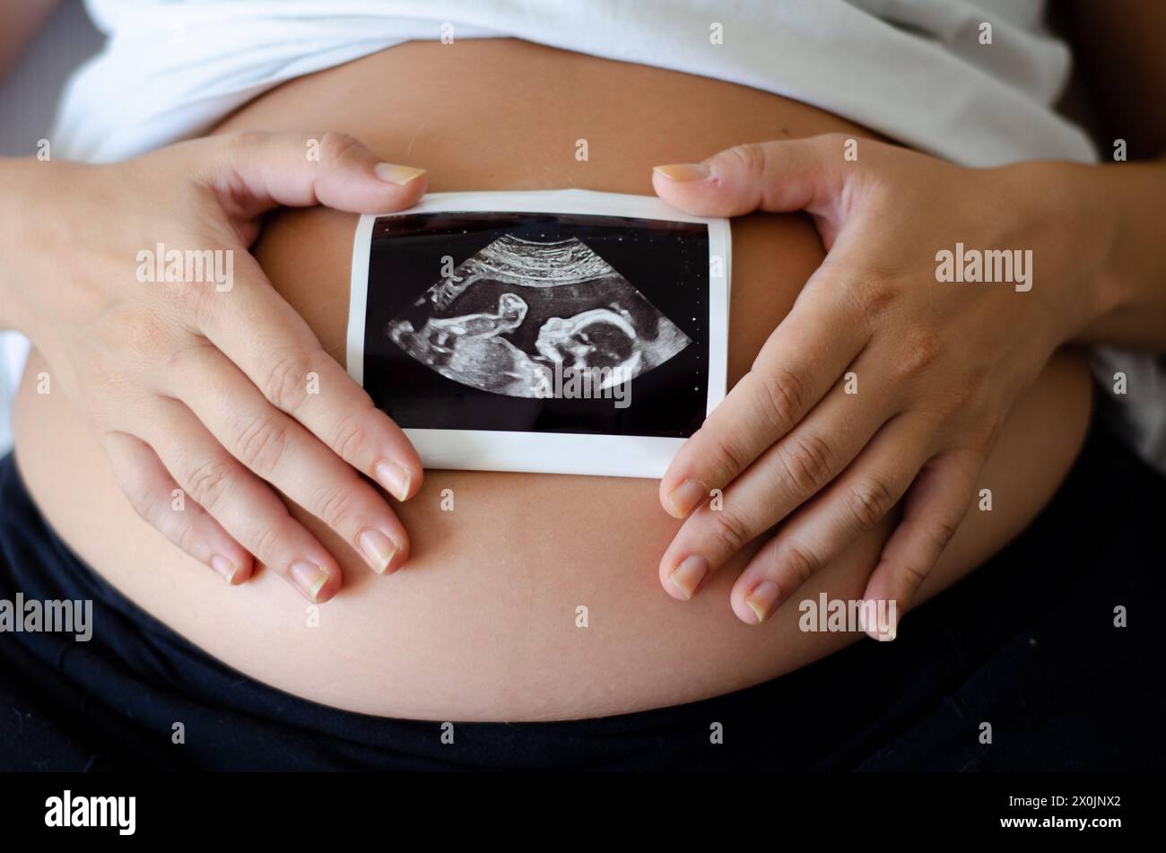 Donna incinta con un'immagine ecografica del bambino Foto Stock