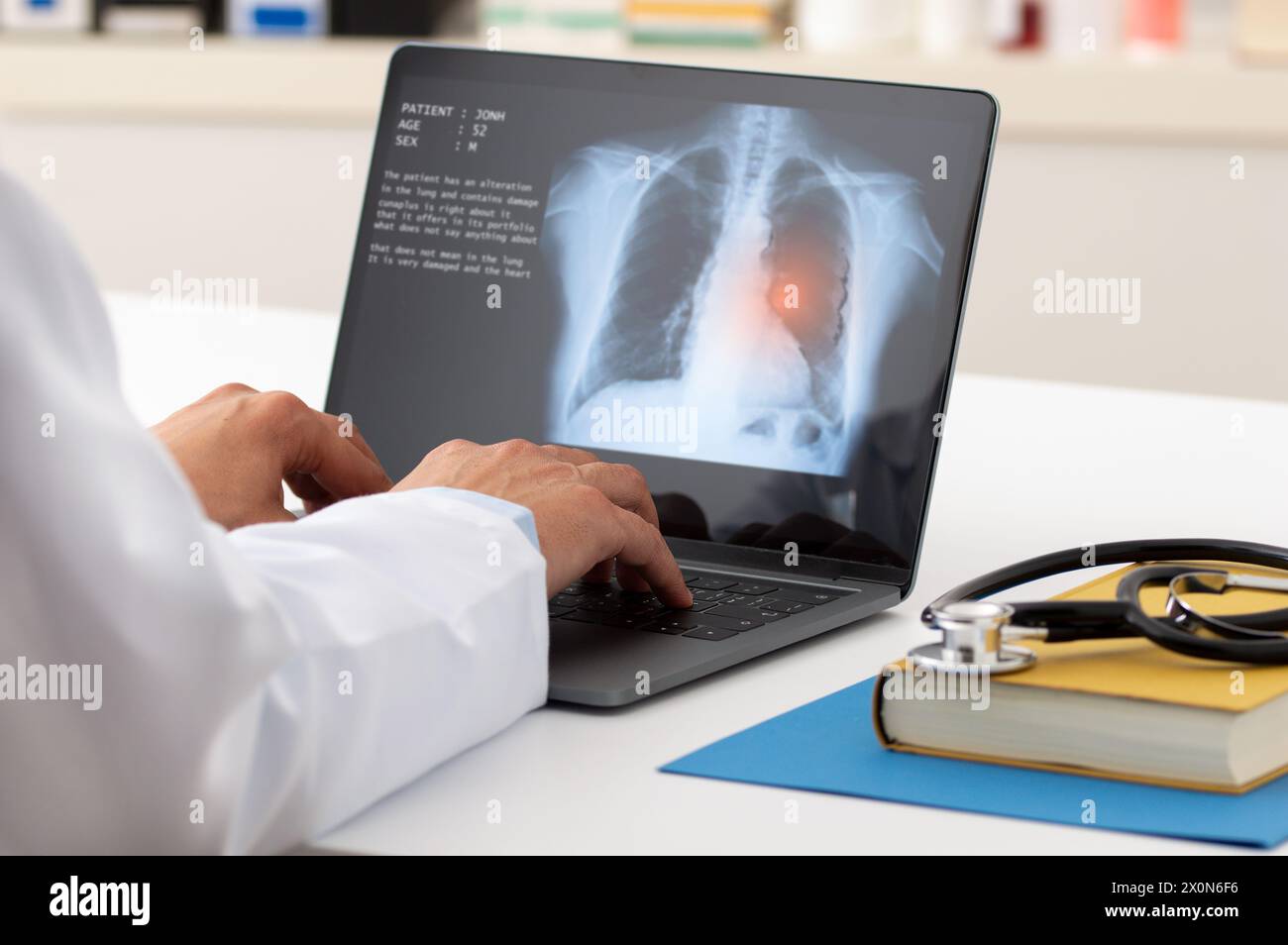 Un pulmonologo che lavora con il portatile in ufficio. Concetto di assistenza sanitaria. Foto Stock