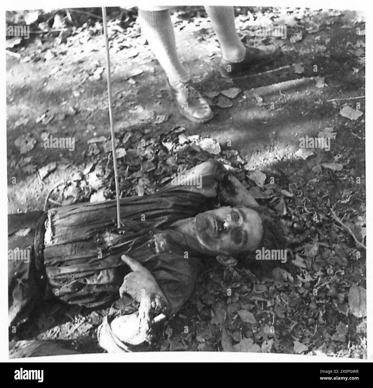 Un uomo mostra un polso rotto e una ferita a baionetta al collo, documentando le atrocità tedesche a Pompei. Foto Stock