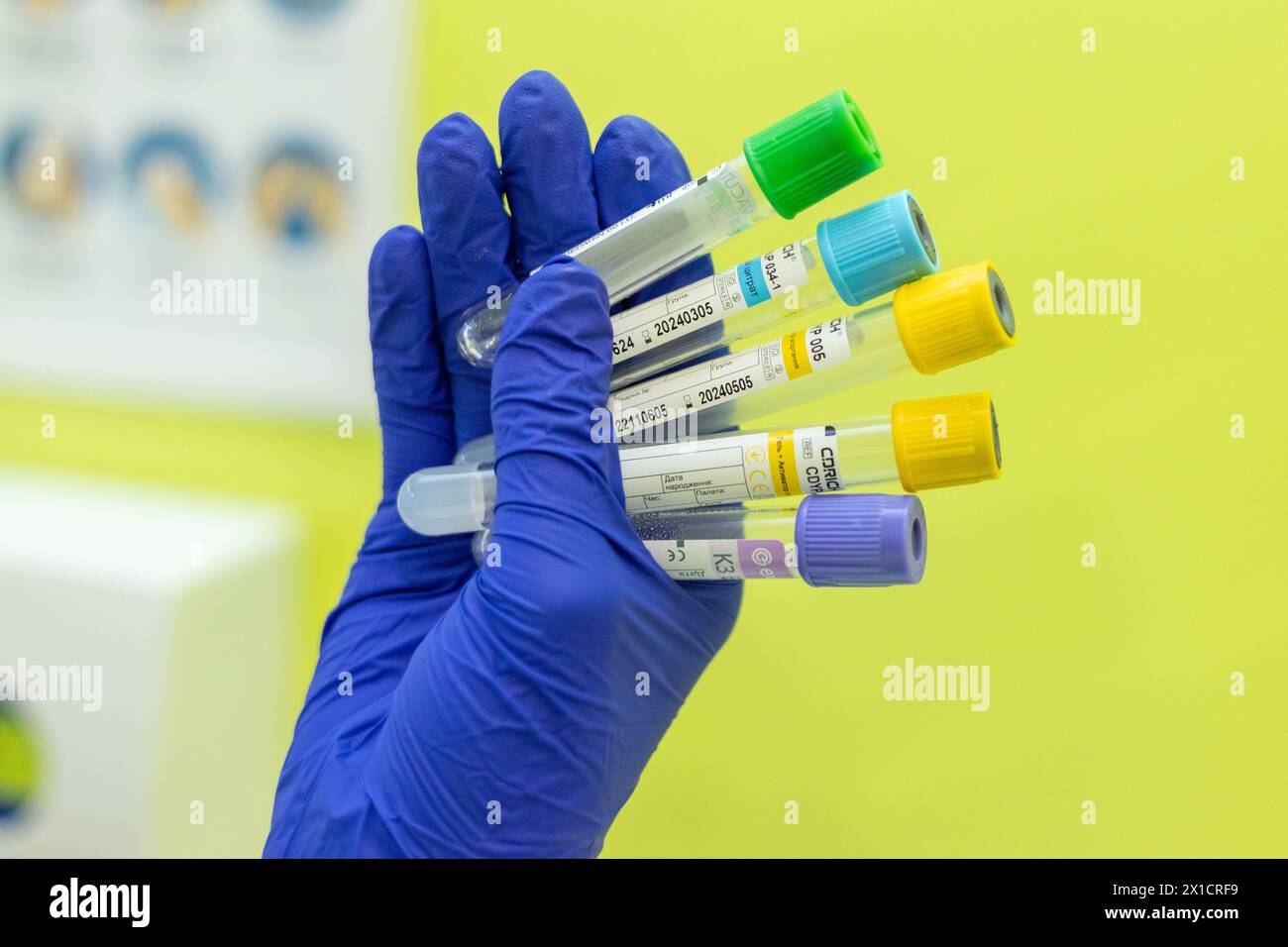 Un infermiere con guanti blu tiene le provette per analisi. Trattamento in ospedale. Varie provette per analisi dei campioni. Iniezioni terapeutiche. Esami in ospedale. Foto Stock