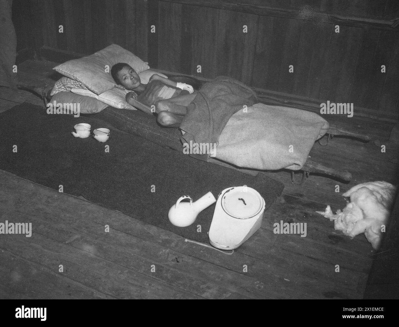 Un ragazzo birmano di 12 anni picchiato dai giapponesi con pale e mozziconi di fucile, soffre di ferite da baionetta. E' stato sepolto vivo in una tomba poco profonda, ma e' strisciato fuori CA. 1945 Foto Stock