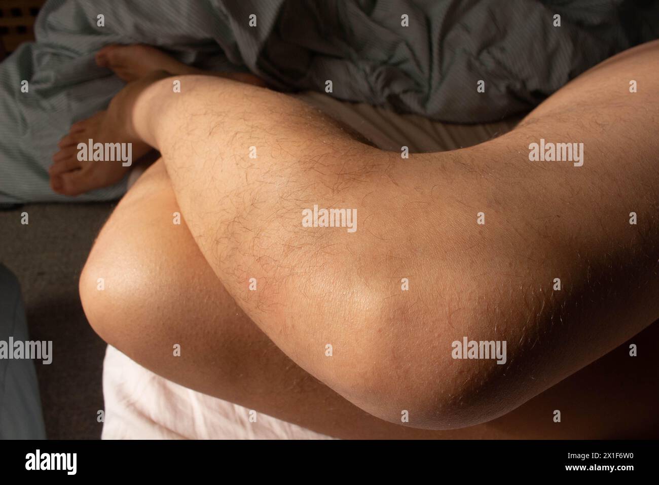 Celebra la bellezza dell'autenticità con questa accattivante immagine che mostra l'eleganza naturale delle gambe pelose femminili Foto Stock