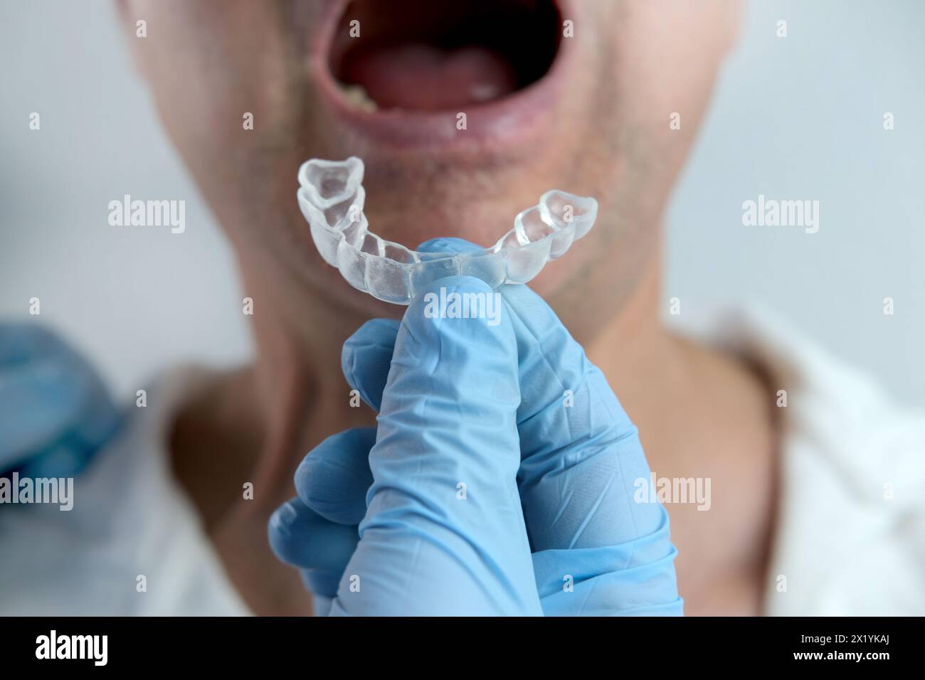 primo piano medico di sesso maschile conduce un esame della cavità orale di vecchio paziente di sesso maschile, prova su silicone Night Mouth Guard per denti clenching Grinding Denta Foto Stock