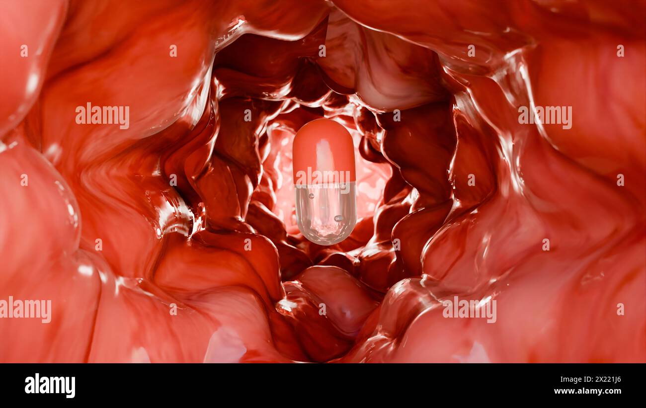 Probiotici nel tratto intestinale. endoscopia attraverso l'intestino. Microbiota, Capsula per pillole con vitamine per l'apparato digerente, trattamento del dolore allo stomaco, Rosso Foto Stock