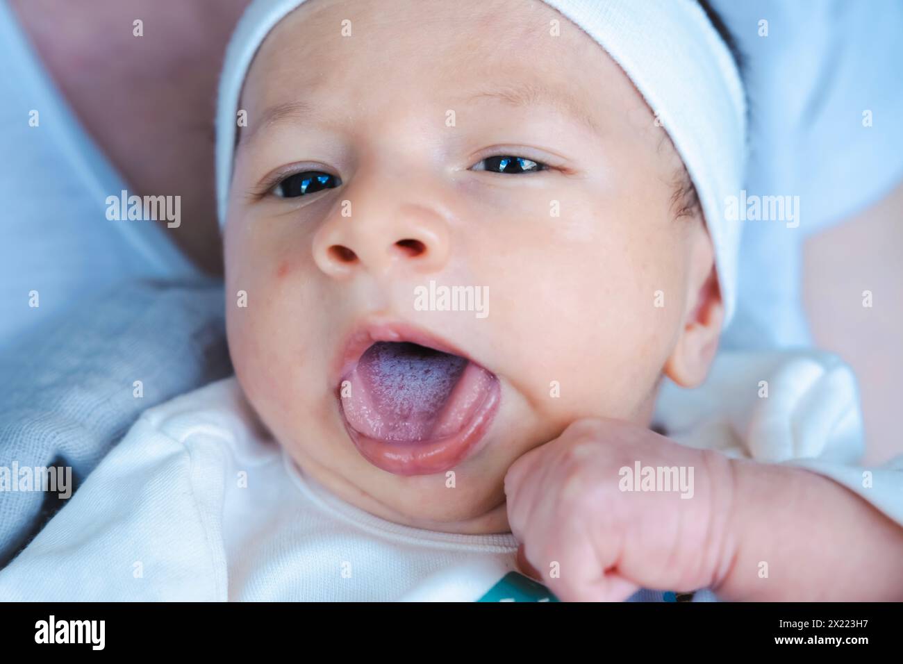 Il neonato ha il muso sulla lingua. Malattie del bambino. Cura dei bambini. Il mughetto, un'infezione fungina che si verifica nella bocca o sulla superficie della lingua, è un dis Foto Stock