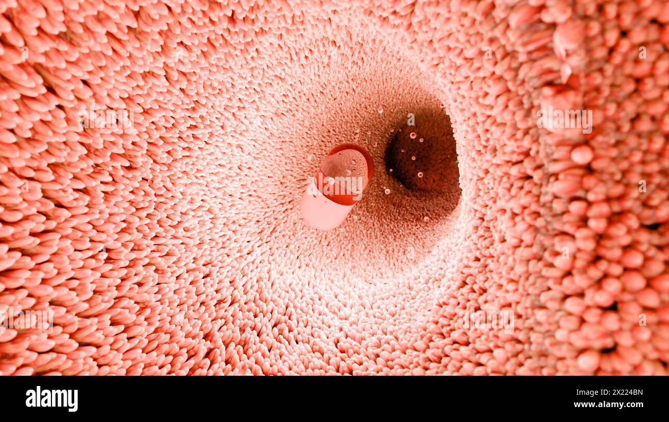 Probiotici nel tratto intestinale. endoscopia attraverso l'intestino. Microbiota, Capsula per pillole con vitamine per l'apparato digerente, trattamento del dolore allo stomaco, Rosso Foto Stock
