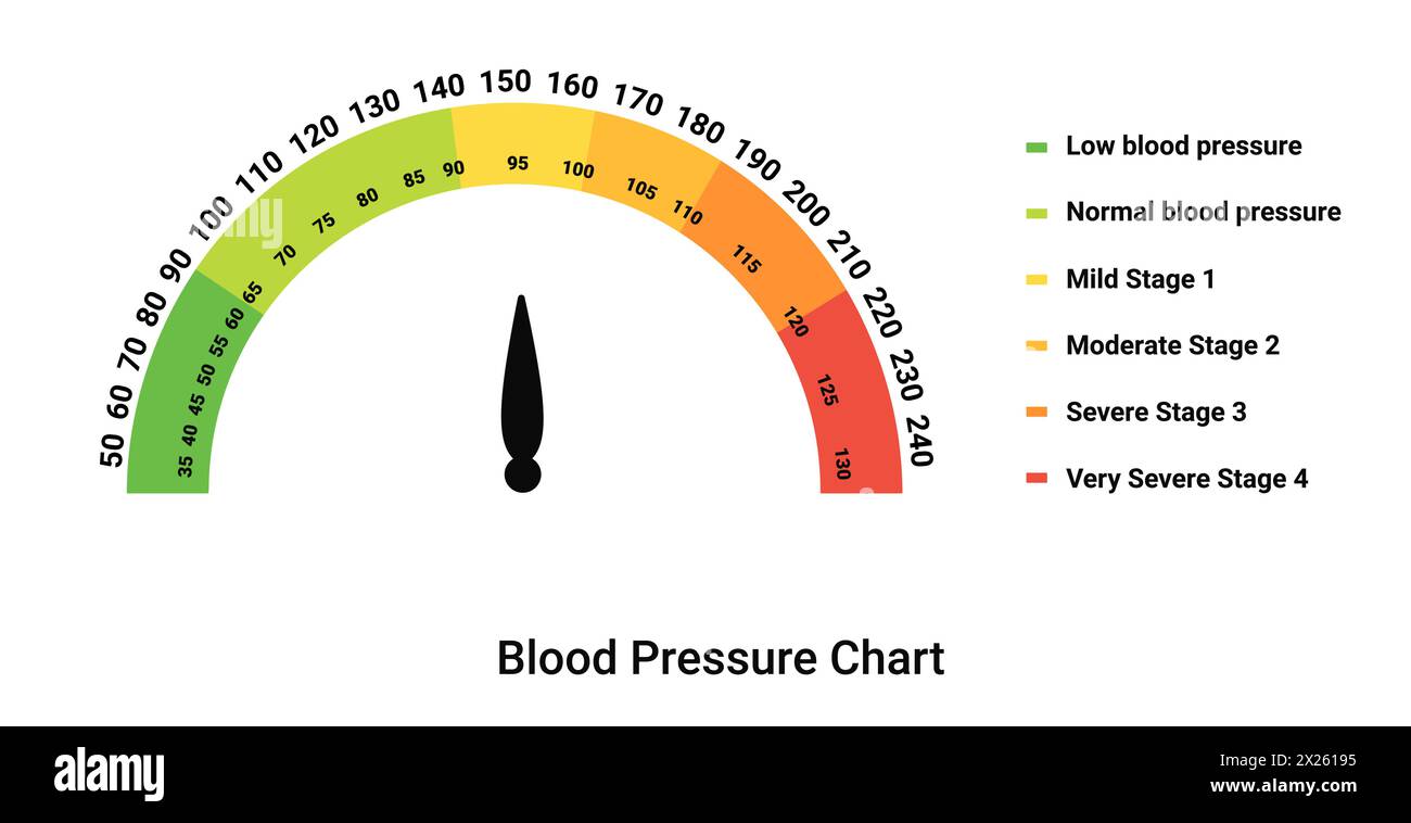 Grafico della pressione sanguigna. Scala di colori con indicatori a freccia e diagrammi Illustrazione Vettoriale