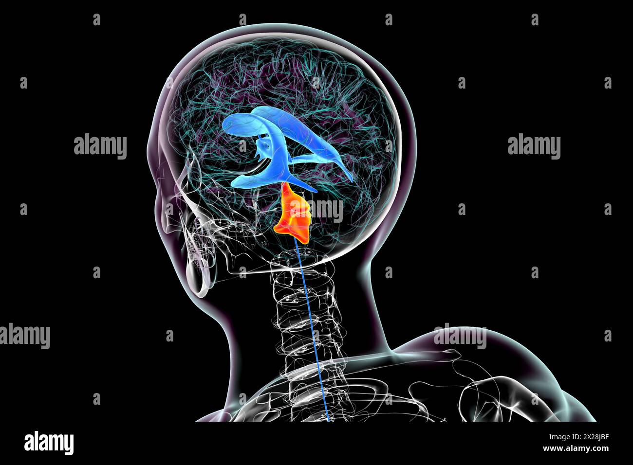 Ingrandimento del quarto ventricolo cerebrale, illustrazione Foto Stock