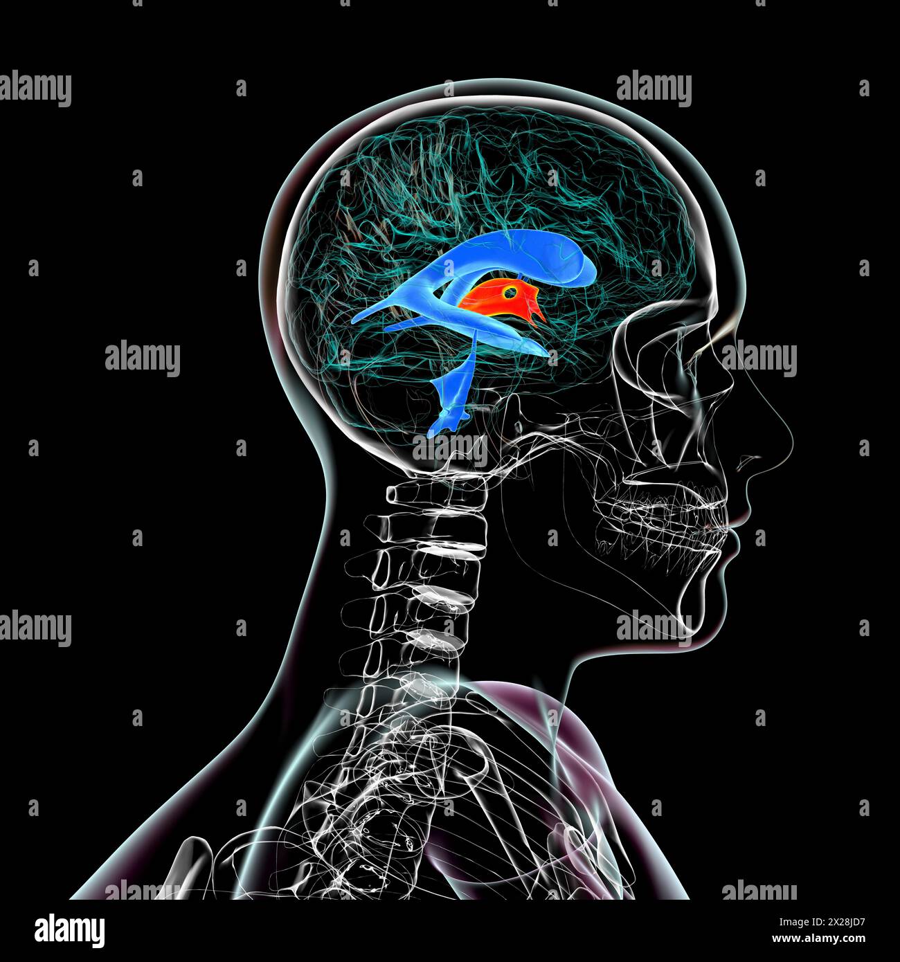 Terzo ventricolo cerebrale, illustrazione Foto Stock