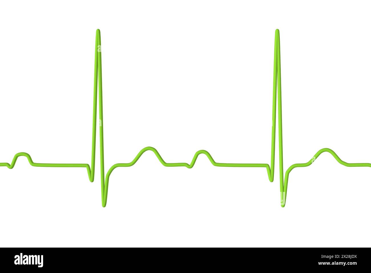 ECG con blocco AV di primo grado, illustrazione Foto Stock