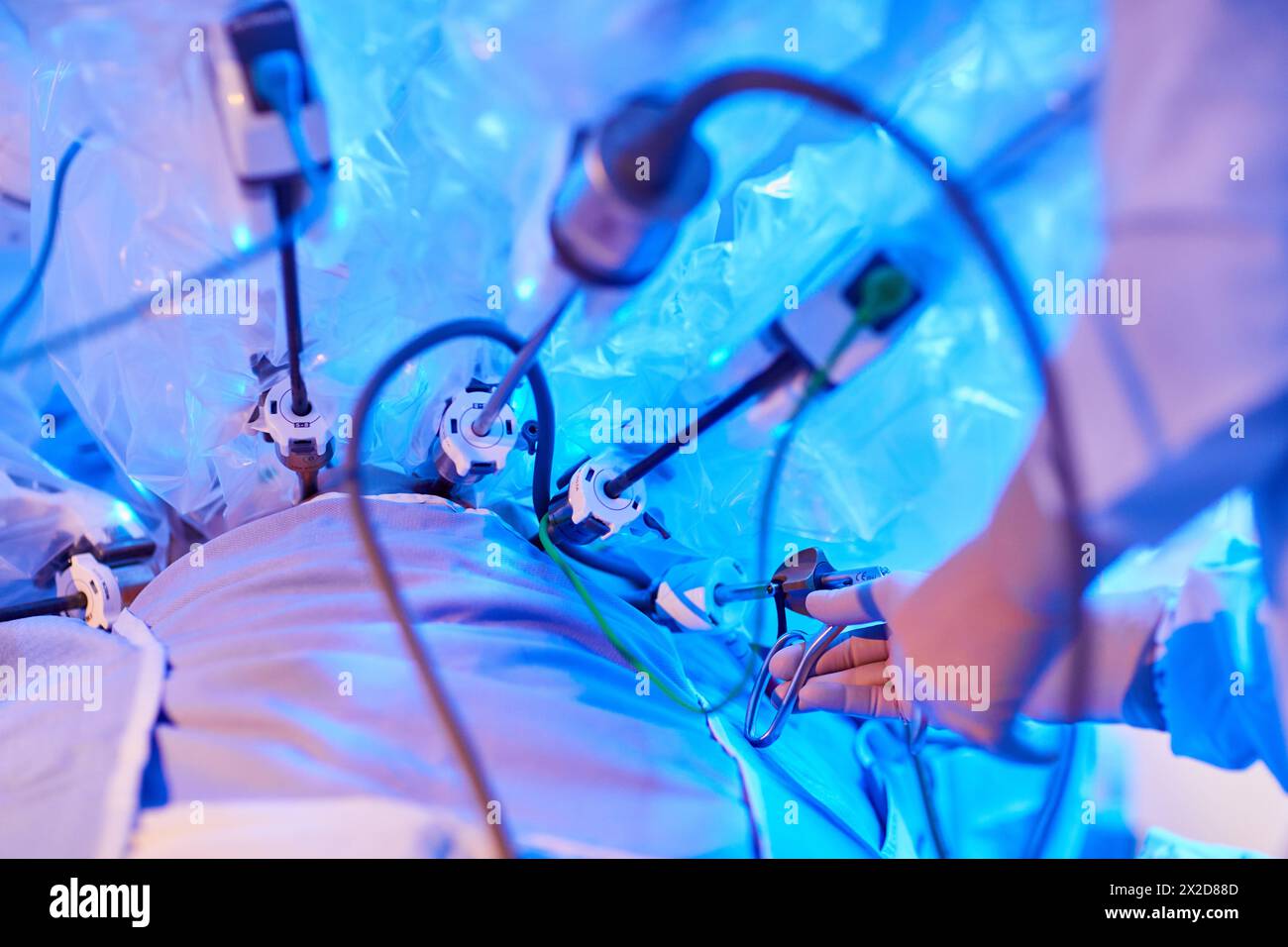 Trattamento chirurgico del cancro alla prostata, prostatectomia radicale, robot chirurgico da Vinci, Team di chirurghi di medici Madina e Azparren, urologia, Chirurgia Foto Stock