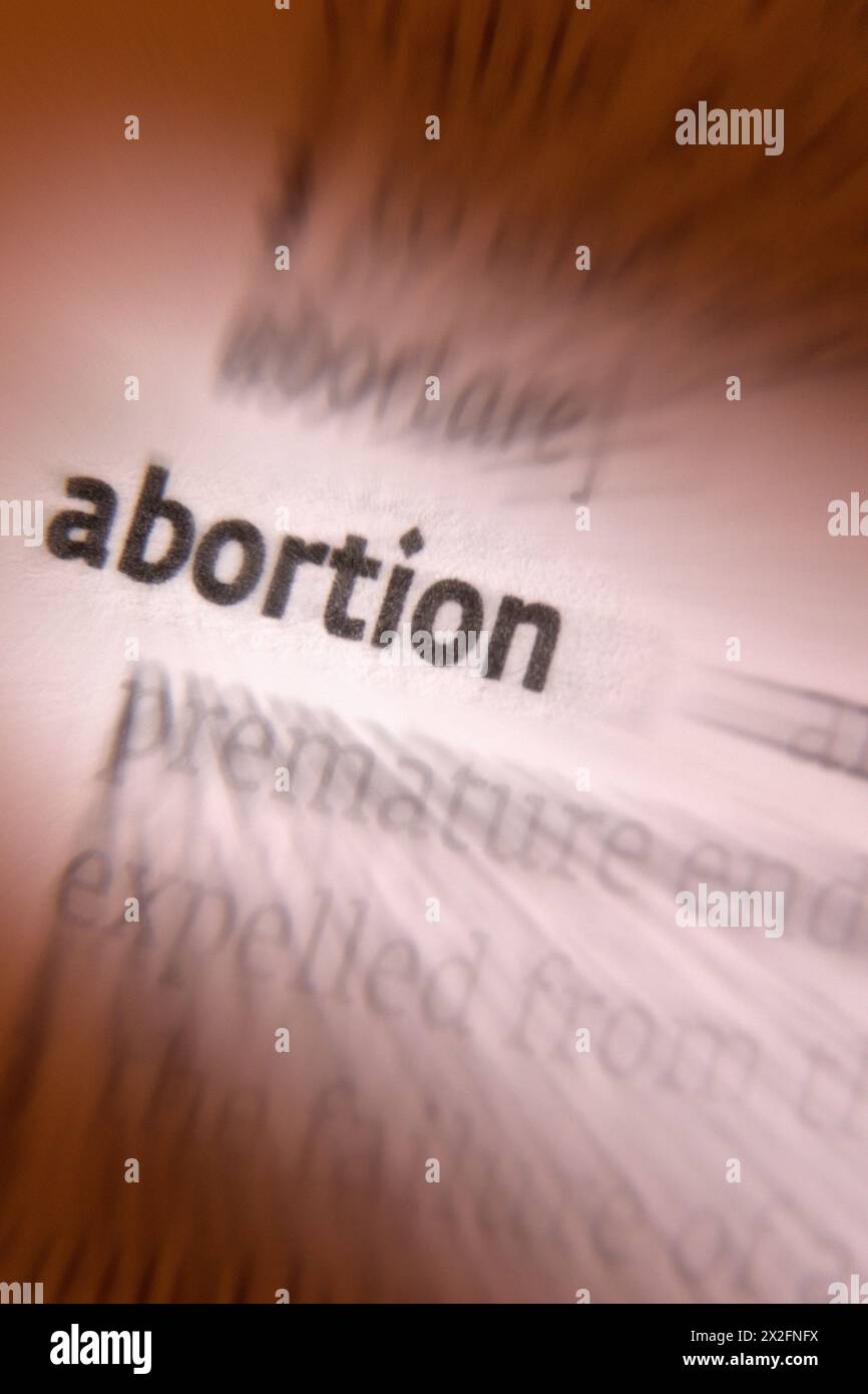 L'aborto è l'interruzione di una gravidanza mediante asportazione o espulsione di un embrione o di un feto. Un aborto che si verifica senza intervento è noto come Am Foto Stock