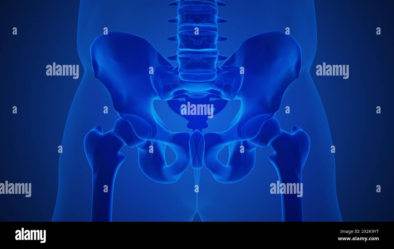 Concetto di anatomia di un'articolazione sacroiliaca artritica Foto Stock