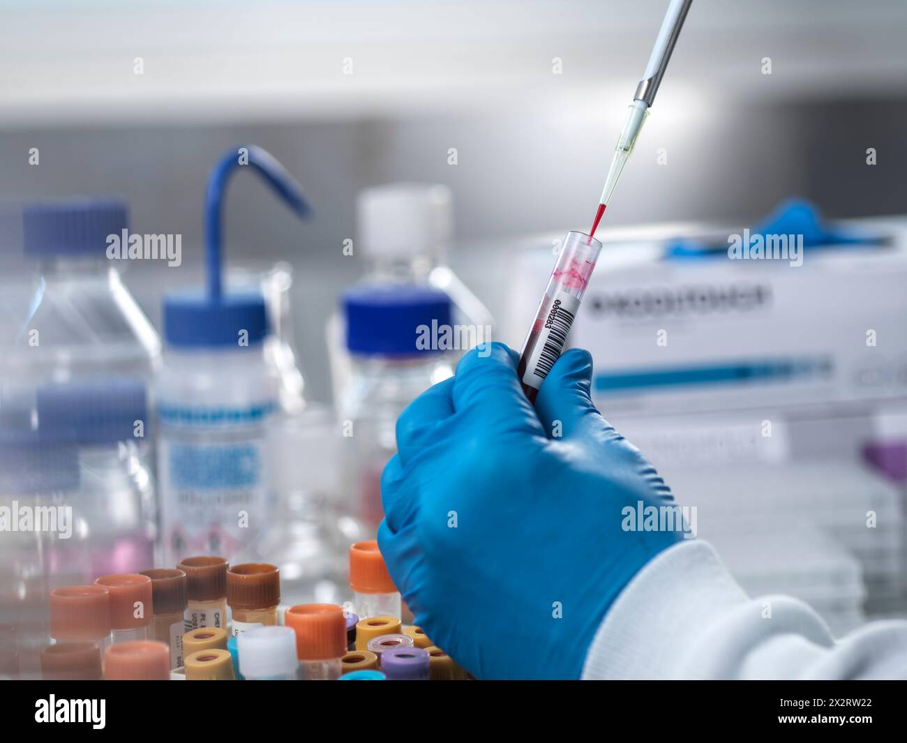 Il patologo pipettando il campione di sangue in laboratorio Foto Stock