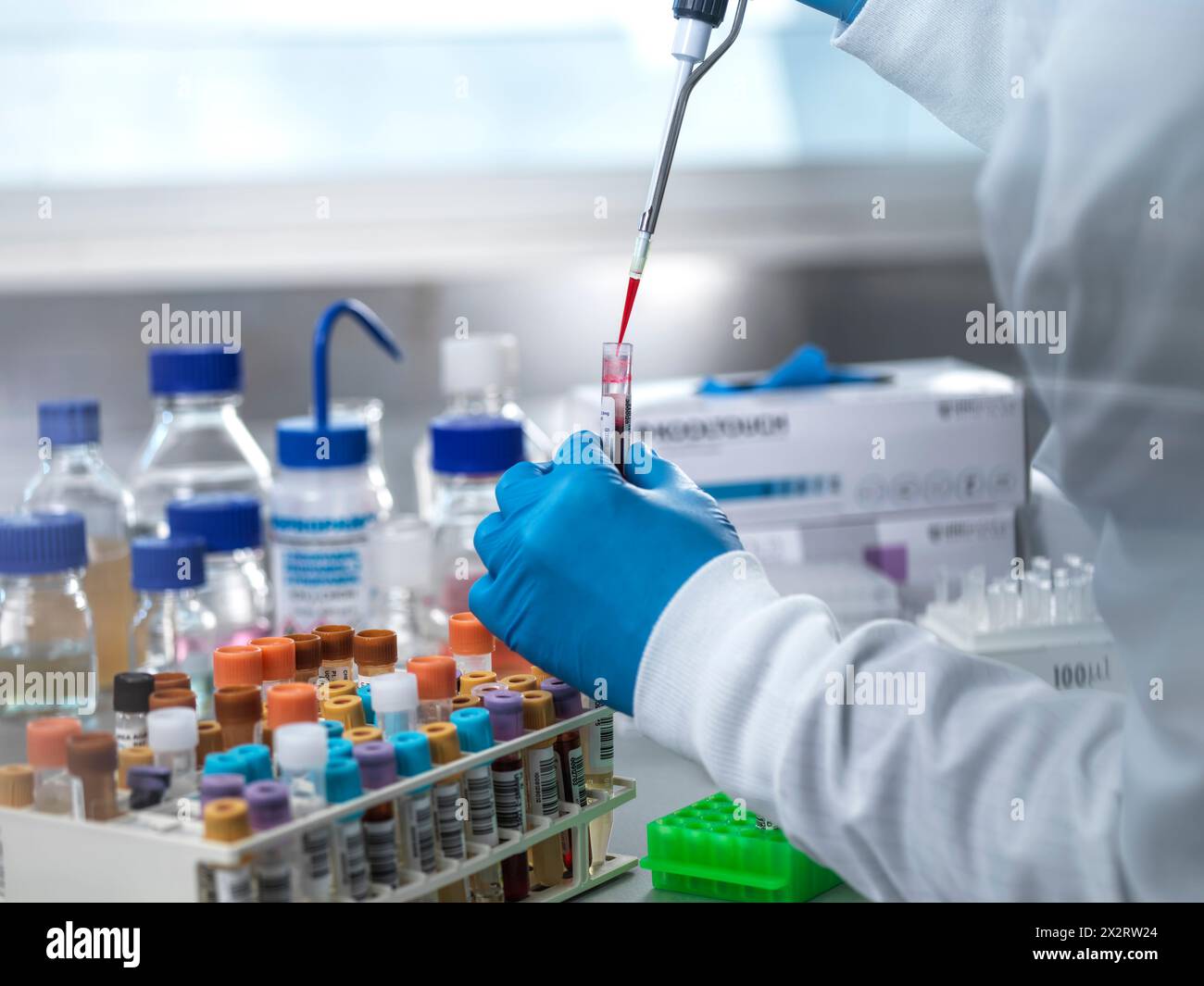 Il patologo pipettando il campione di sangue nella provetta di analisi del laboratorio Foto Stock