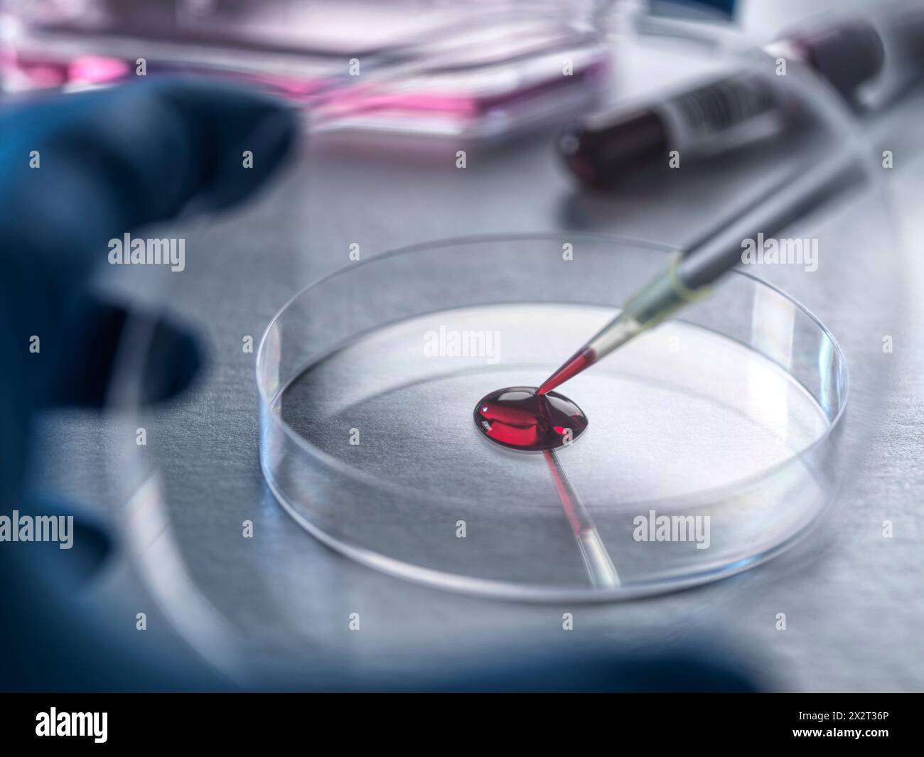 Scienziato che analizza il campione di sangue umano in laboratorio Foto Stock