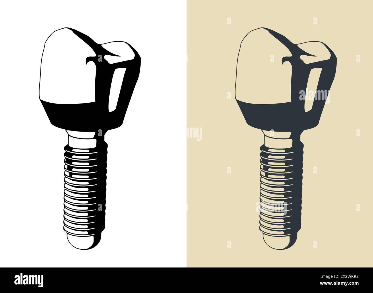 Illustrazioni vettoriali stilizzate di protesi dentale Illustrazione Vettoriale