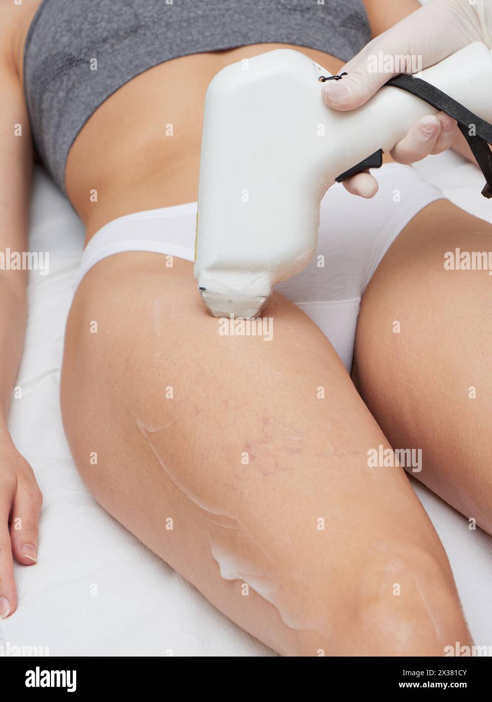 Estetista che rimuove i capelli del corpo di giovane donna Foto Stock