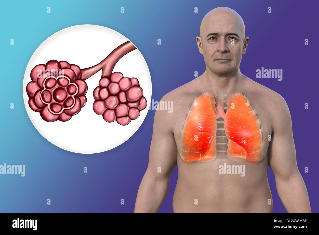Illustrazione di un uomo con polmoni sani insieme a vista ravvicinata di alveoli polmonari. Foto Stock