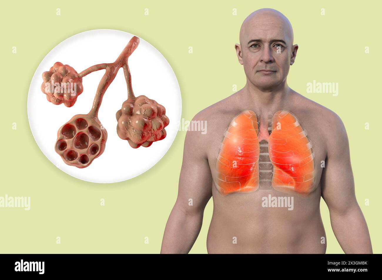 Illustrazione di un uomo con polmoni sani insieme a vista ravvicinata di alveoli polmonari. Foto Stock